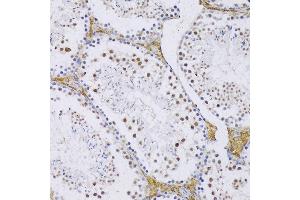 Immunohistochemistry of paraffin-embedded Mouse testis using SRSF3 antibody (ABIN6132649, ABIN6148465, ABIN6148466 and ABIN6221693) at dilution of 1:100 (20x lens). (SRSF3 antibody  (AA 1-90))