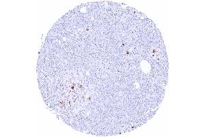 Pancreas Strong somatostatin positivity of a subset of pancreatic islet cells (Recombinant Somatostatin antibody)
