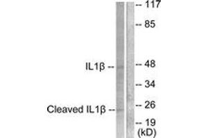 Western blot analysis of extracts from NIH-3T3 cells, treated with Etoposide 25uM 60', using IL-1 beta (Cleaved-Asp210) Antibody. (IL-1 beta antibody  (Cleaved-Asp210))