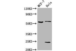 Western Blot Positive WB detected in: MCF-7 whole cell lysate, Hela whole cell lysate All lanes: SLC45A2 antibody at 5.
