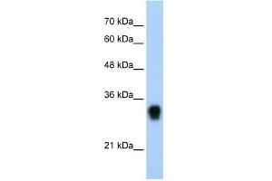WB Suggested Anti-RPL8 Antibody Titration:  0. (RPL8 antibody  (C-Term))