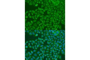 Immunofluorescence analysis of U2OS cells using FXR2 antibody (ABIN1872752) at dilution of 1:100. (FXR2 antibody)