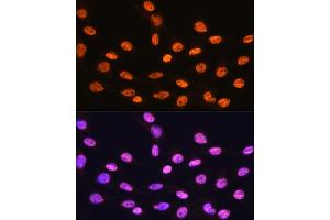 Immunofluorescence analysis of C6 cells using hnRNP K Rabbit mAb (ABIN7267634) at dilution of 1:100 (40x lens). (HNRNPK antibody)