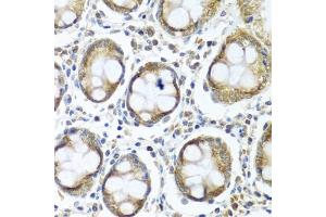 Immunohistochemistry of paraffin-embedded human colon using IFI44 antibody (ABIN6135120, ABIN6142168, ABIN6142169 and ABIN6224213) at dilution of 1:100 (40x lens). (IFI44 antibody)