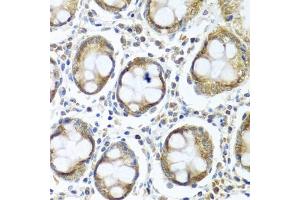 Immunohistochemistry of paraffin-embedded human colon using IFI44 antibody (ABIN6135120, ABIN6142168, ABIN6142169 and ABIN6224213) at dilution of 1:100 (40x lens). (IFI44 antibody)