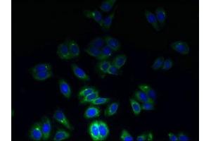 Tetraspanin 7 antibody  (AA 113-223)