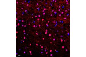 Immunofluorescence of paraffin embedded mouse brain using Api5 (ABIN7073094) at dilution of 1:400 (400x lens) (Apoptosis Inhibitor 5 antibody)