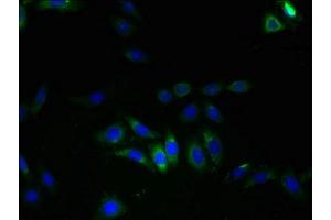Immunofluorescence (IF) image for anti-Leucine Rich Repeat Containing 8 Family, Member E (LRRC8E) (AA 353-630) antibody (ABIN7175622)