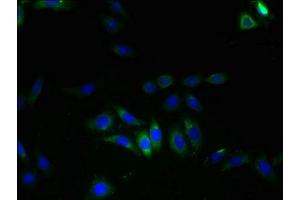 Immunofluorescent analysis of HepG2 cells using ABIN7175622 at dilution of 1:100 and Alexa Fluor 488-congugated AffiniPure Goat Anti-Rabbit IgG(H+L) (LRRC8E antibody  (AA 353-630))