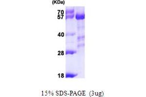 SDS-PAGE (SDS) image for Protein Phosphatase 3, Catalytic Subunit, alpha Isoform (PPP3CA) (AA 1-511) protein (His tag) (ABIN6386673)