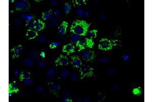 Anti-ACO2 mouse monoclonal antibody (ABIN2452695) immunofluorescent staining of COS7 cells transiently transfected by pCMV6-ENTRY ACO2 (RC204307). (ACO2 antibody)