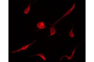 ABIN6267462 staining K562 by IF/ICC. (Cyclin D3 antibody  (pThr283))