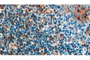 Immunohistochemistry (IHC) image for anti-HLA-DR-gamma (CD74) (AA 78-222) antibody (ABIN7443692)
