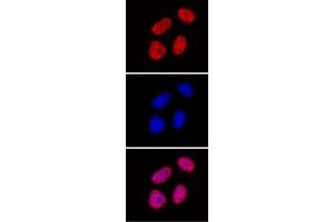 Histone H3 di/trimethyl Lys27 antibody (mAb) tested by immunofluorescence. (Histone 3 antibody  (H3K27me2, H3K27me3))