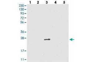 Western blot analysis of Lane 1: RT-4, Lane 2: U-251 MG, Lane 3: Human Plasma, Lane 4: Liver, Lane 5: Tonsil with VSTM2A polyclonal antibody .