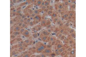 Used in DAB staining on fromalin fixed paraffin- embedded Kidney tissue (MMP21 antibody  (AA 335-547))