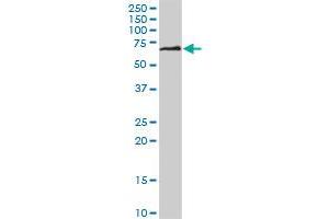 DPYSL5 monoclonal antibody (M04), clone 2D10. (DPYSL5 antibody  (AA 1-564))