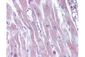 Immunohistochemistry (IHC) image for anti-Actin-Related Protein 2 (ACTR2) antibody (ABIN2855610)