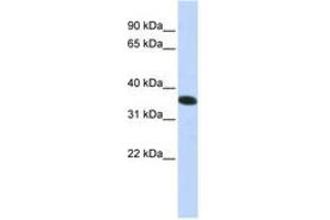 Image no. 1 for anti-Chromosome 21 Open Reading Frame 59 (C21orf59) (N-Term) antibody (ABIN6740941) (C21orf59 antibody  (N-Term))