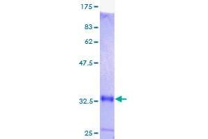 MT1M Protein (AA 1-61) (GST tag)
