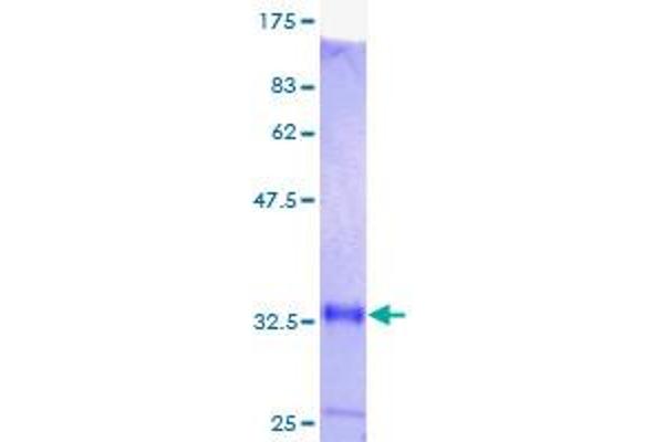 MT1M Protein (AA 1-61) (GST tag)