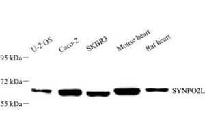 Western blot analysis of SYNPO2L (ABIN7075791) at dilution of 1: 2000 (SYNPO2L antibody)