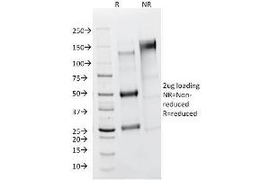 SDS-PAGE Analysis Purified FSH Receptor Mouse Monoclonal Antibody (FSHR/1400). (FSHR antibody)
