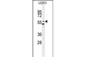 CCDC9 Antibody (N-term) (ABIN654741 and ABIN2844427) western blot analysis in  cell line lysates (35 μg/lane).