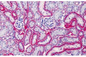 Mouse Kidney: Formalin-Fixed, Paraffin-Embedded (FFPE) (CD147 antibody)