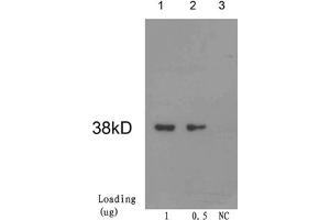 Loading: Cre recombinase proteinPrimary antibody: 1 µg/mL Mouse Anti-Cre Recombinase Monoclonal Antibody (ABIN398566) Secondary antibody: Goat Anti-Mouse IgG (H&L) [HRP] Polyclonal Antibody (ABIN398387, 1: 10,000) The signal was developed with LumiSensorTM HRP Substrate Kit (ABIN769939)