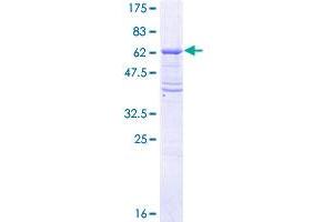 Image no. 1 for Transforming Growth Factor, beta Receptor II (70/80kDa) (TGFBR2) (AA 1-334) protein (GST tag) (ABIN1322611) (TGFBR2 Protein (AA 1-334) (GST tag))