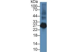 Detection of LAT2 in Rat Spleen lysate using Polyclonal Antibody to Linker For Activation Of T-Cells Family, Member 2 (LAT2) (LAT2 antibody  (AA 32-192))