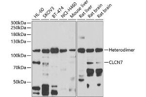 Western blot analysis of extracts of various cell lines, using CLCN7 antibody (ABIN6133268, ABIN6138670, ABIN6138672 and ABIN6222613) at 1:1000 dilution. (CLCN7 antibody  (AA 626-805))