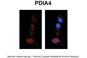 Sample Type: NT2 cells Red: Antibody Blue: DAPI Primary Dilution: 1ug/50ul antibody Secondary Antibody: Alexa goat anti-rabbit 594 Image Submitted by: Yuzhi Chen, University of Arkansas for Medical Sciences (PDIA4 antibody  (N-Term))