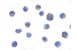 Immunohistochemistry (IHC) image for anti-conserved Helix-Loop-Helix Ubiquitous Kinase (CHUK) antibody (ABIN1030208) (IKK alpha antibody)