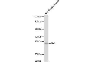 SIX2 antibody  (C-Term)