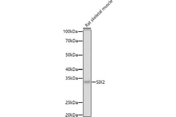 SIX2 antibody  (C-Term)