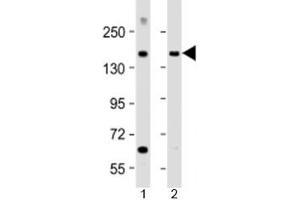 Western blot testing of human 1) brain and 2) lung lysate with MTUS1 antibody at 1:2000. (MTUS1 antibody  (AA 183-226))