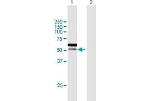 Western Blot analysis of C1orf124 expression in transfected 293T cell line by C1orf124 MaxPab polyclonal antibody. (Spartan antibody  (AA 1-489))