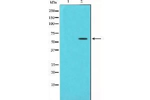 CHEK1 antibody  (pSer280)