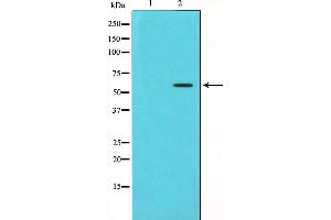 Western blot analysis of Chk1 phosphorylation expression in UV treated HT29 whole cell lysates,The lane on the left is treated with the antigen-specific peptide. (CHEK1 antibody  (pSer280))