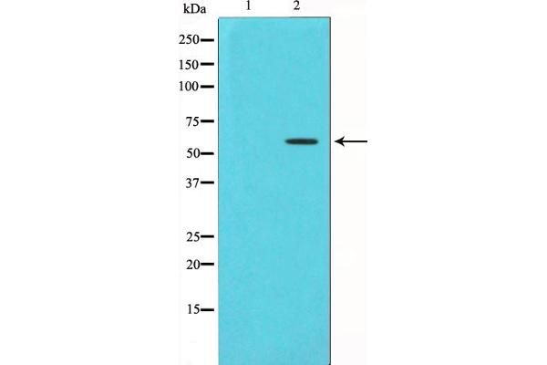 CHEK1 antibody  (pSer280)