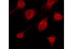 ABIN6266577 staining HeLa by IF/ICC. (Keratin 10 antibody  (Internal Region))