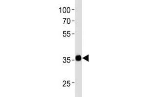 Western blot analysis of lysate from NCCIT cell line using SOX2 antibody at 1:1000.