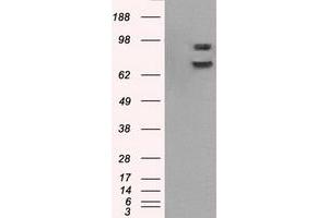 Image no. 15 for anti-P450 (Cytochrome) Oxidoreductase (POR) antibody (ABIN1497744) (POR antibody)