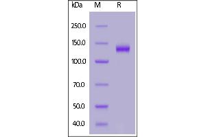 DCC Protein (AA 32-1097) (His tag)