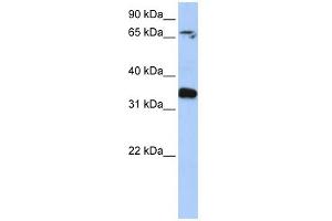 WB Suggested Anti-GLE1 Antibody Titration: 0. (GLE1 antibody  (N-Term))