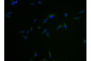 Immunofluorescence staining of Hela cells with ABIN7147892 at 1:100, counter-stained with DAPI. (Claudin 18 antibody  (AA 196-261))
