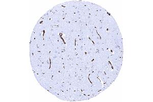 Cerebrum grey matter A particularly strong GLUT1 staining of endothelial cells is seen in the brain (Recombinant GLUT1 antibody  (AA 203-305))