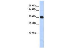 Image no. 1 for anti-Matrilin 2 (MATN2) (AA 791-840) antibody (ABIN6741404) (MATN2 antibody  (AA 791-840))